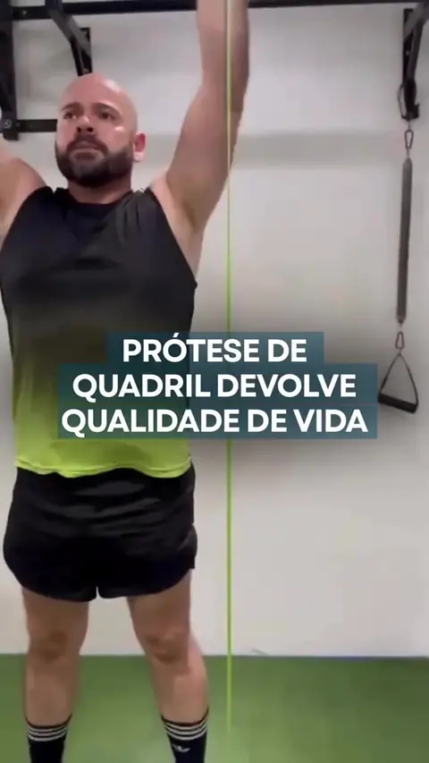 Antes e depois, evolução de paciente operado pelo Dr. Bruno Rabello